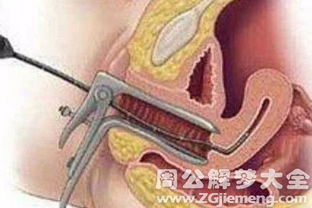 梦见猪流产是什么意思 预兆_梦见怀孕又流产了是什么意思 预兆