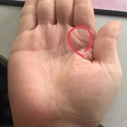 掌心凹陷与厚度——潜力与可靠网