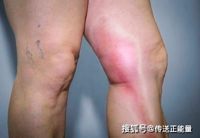 先说说这颗“朱砂印”到底是啥意思