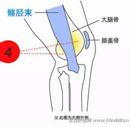 什么风水会引起膝盖疼,什么房子风水好