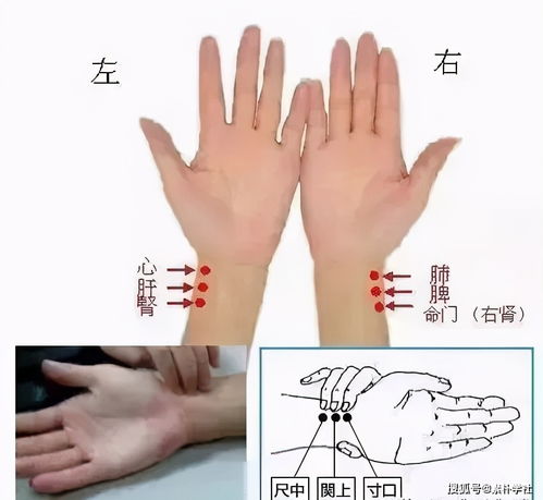那些痣不能点