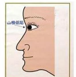 - 鼻孔不露：家庭生活和谐良好兆头